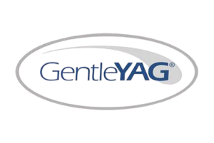 เลเซอร์ขนถาวร กำจัดขนด้วยเครื่อง Gentle YAG มาตรฐานปี 2026